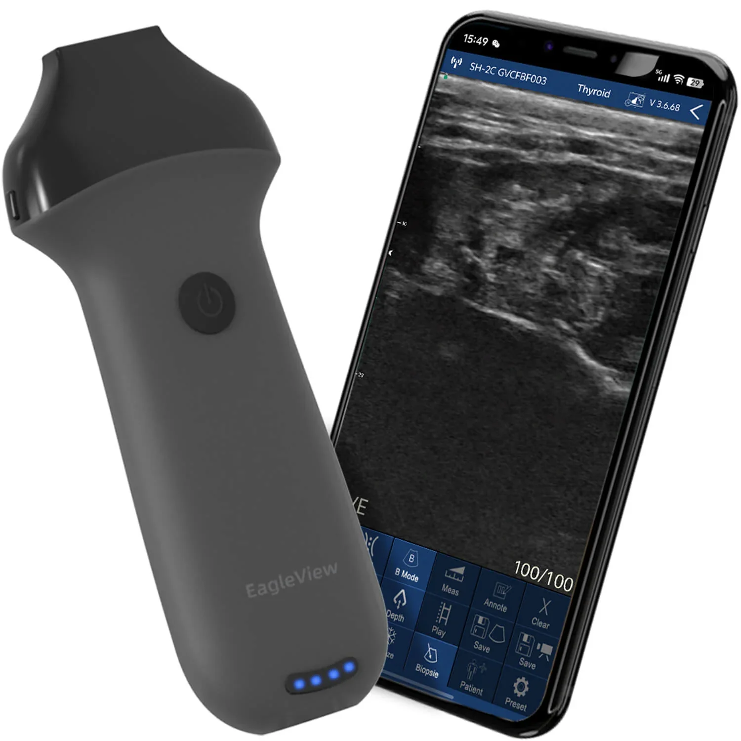 EagleView High-Frequency Linear Wireless Handheld Ultrasound