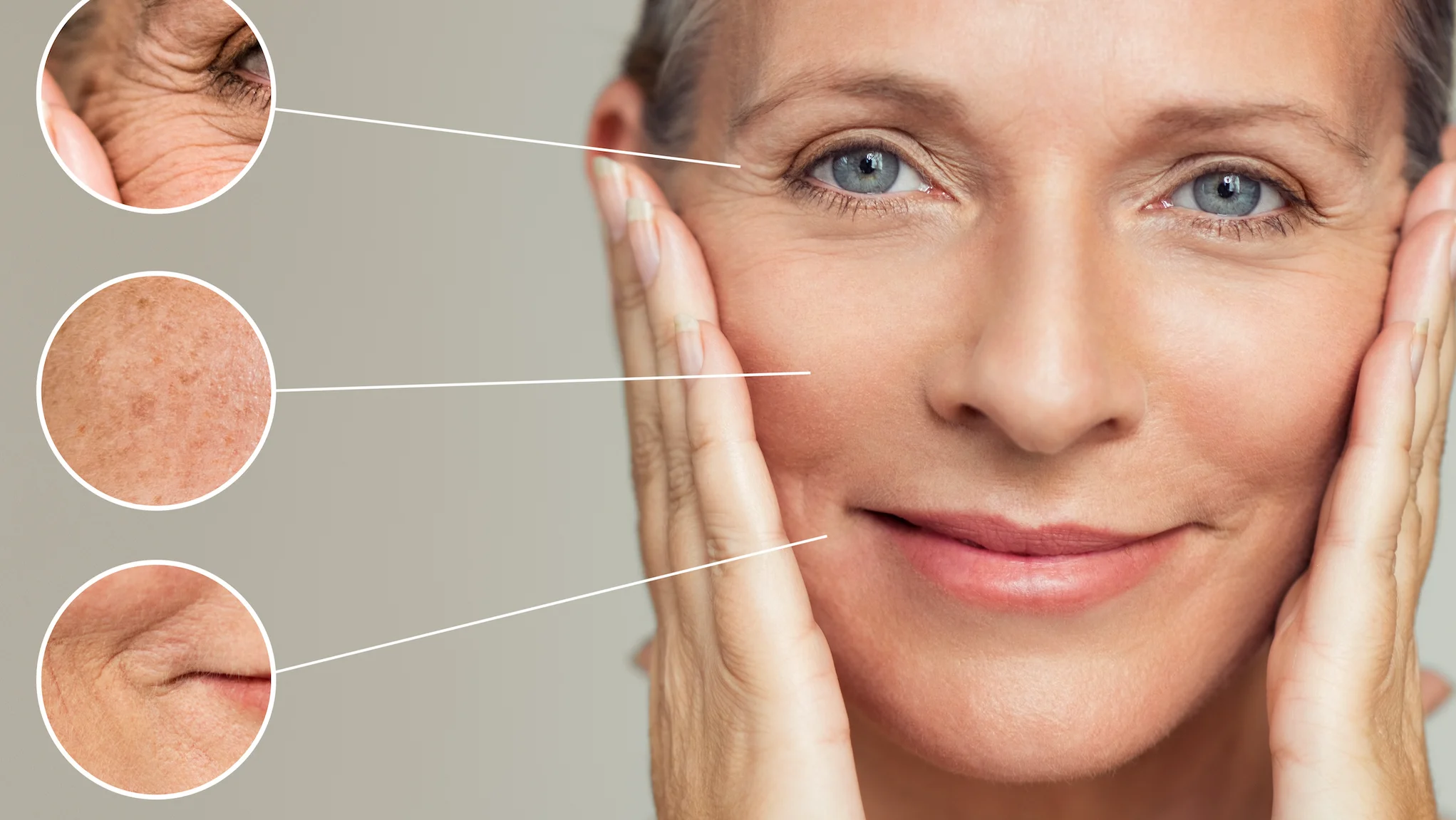 Mona Lisa Hyaluron & Filler 1 ml Behandlung