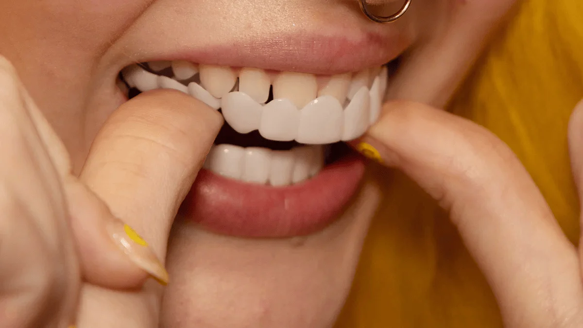 TruSmile Custom Made Veneers (Copy)