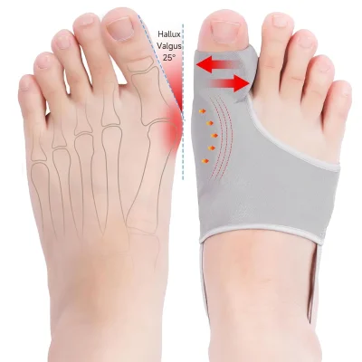 Hyggear Big Toe Bunion [Hallux Valgus] Corrector