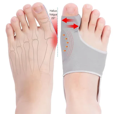 HYGGEAR Big Toe Bunion (Hallux Valgus) Corrector
