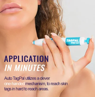 TagPal - Skin Tag Removal Kit